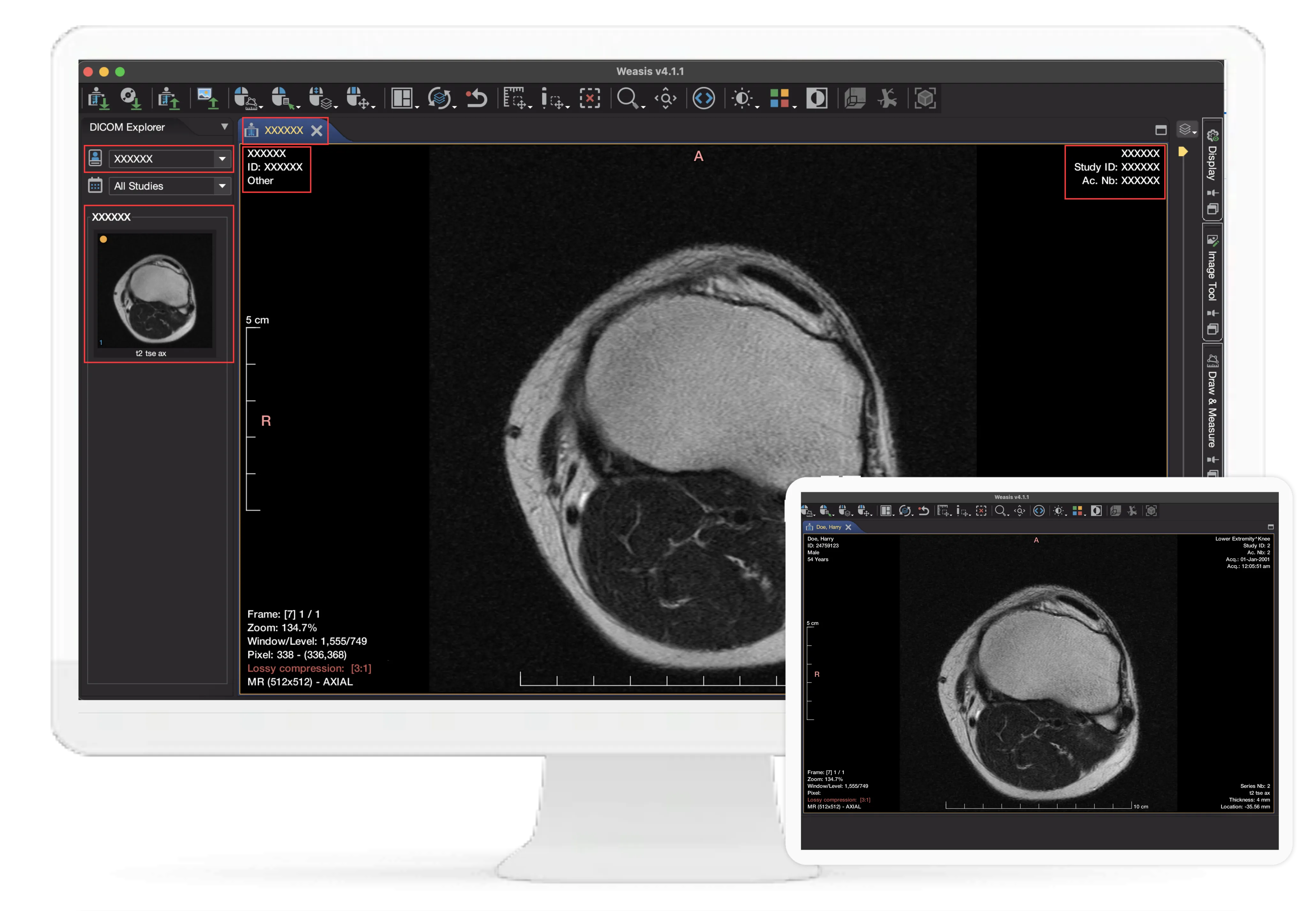 dicom.png