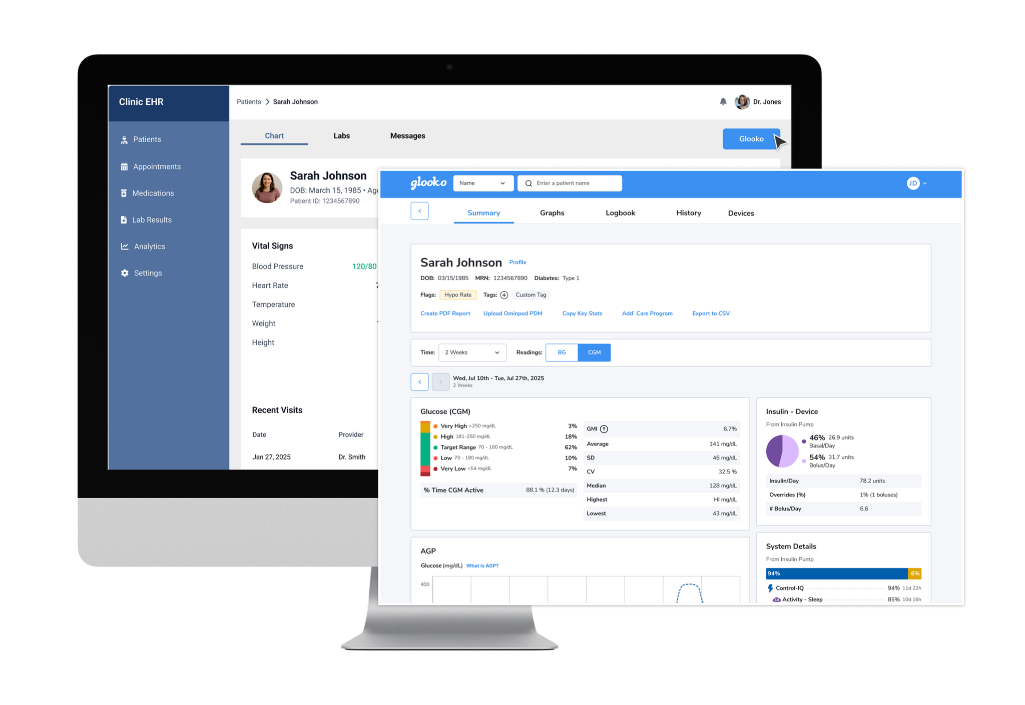 EHR-Integration-with-Glooko-T1-2048x1410.webp