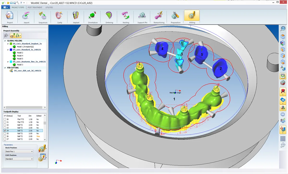WNCD-implant4-big.png