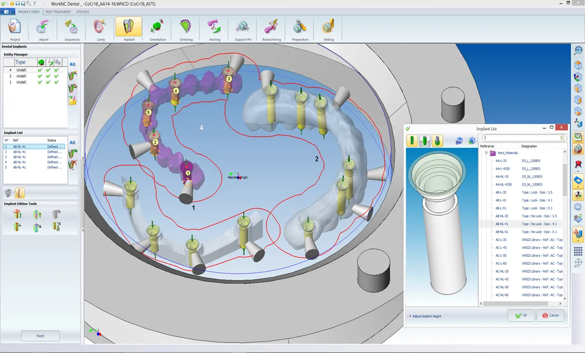 WNCD-implant3-big.png