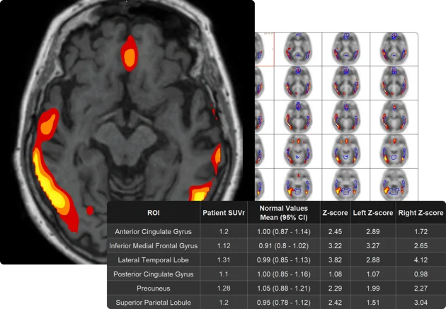 Neuro-Img-3.webp