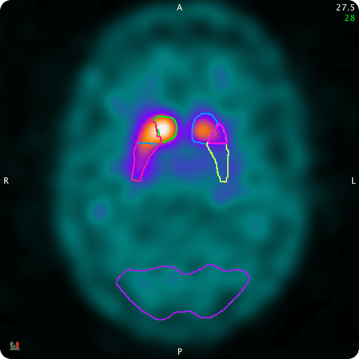 NM-Neuro-Img02.webp