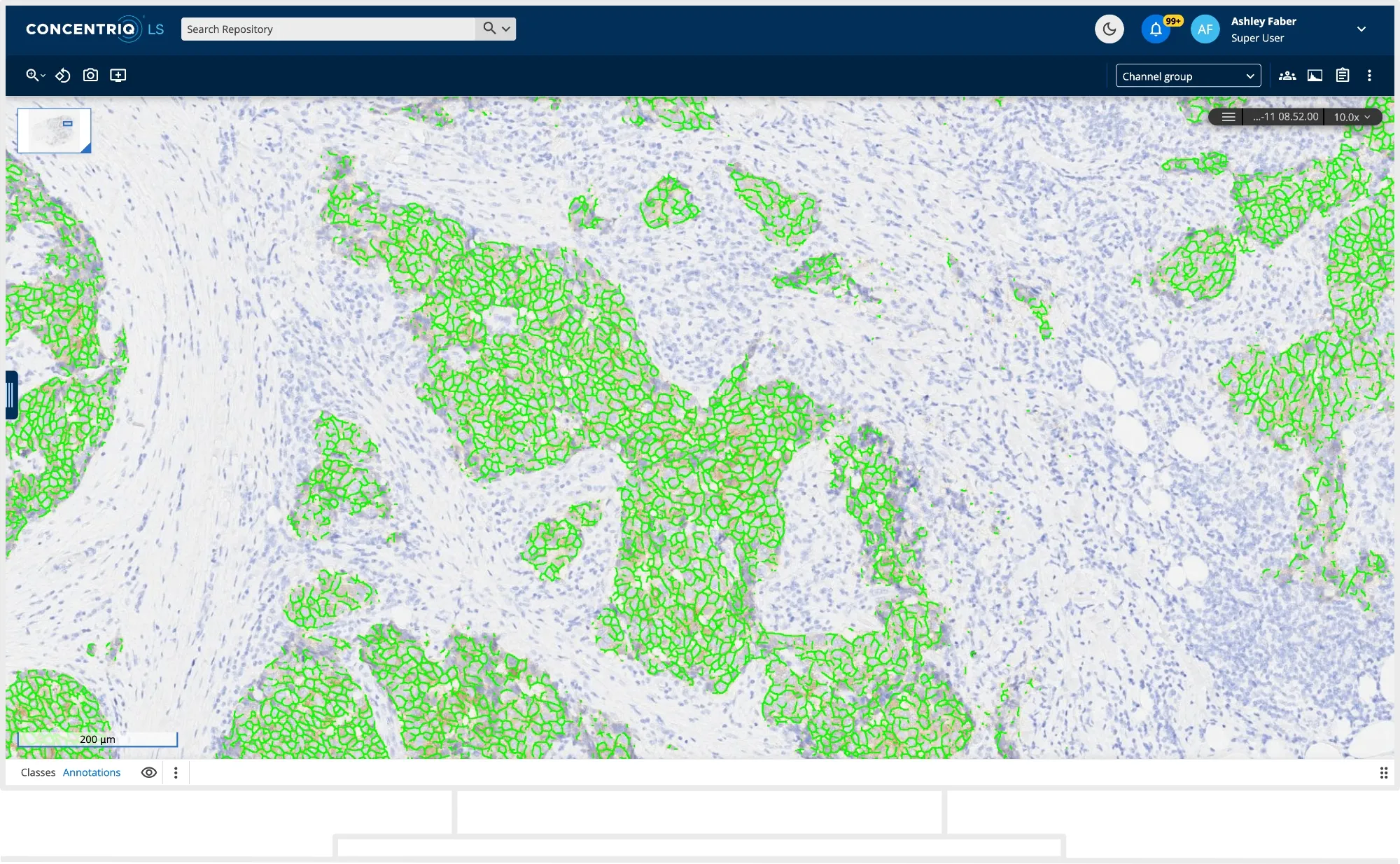 concentriq-ls-clinical-dev_30-3.jpg