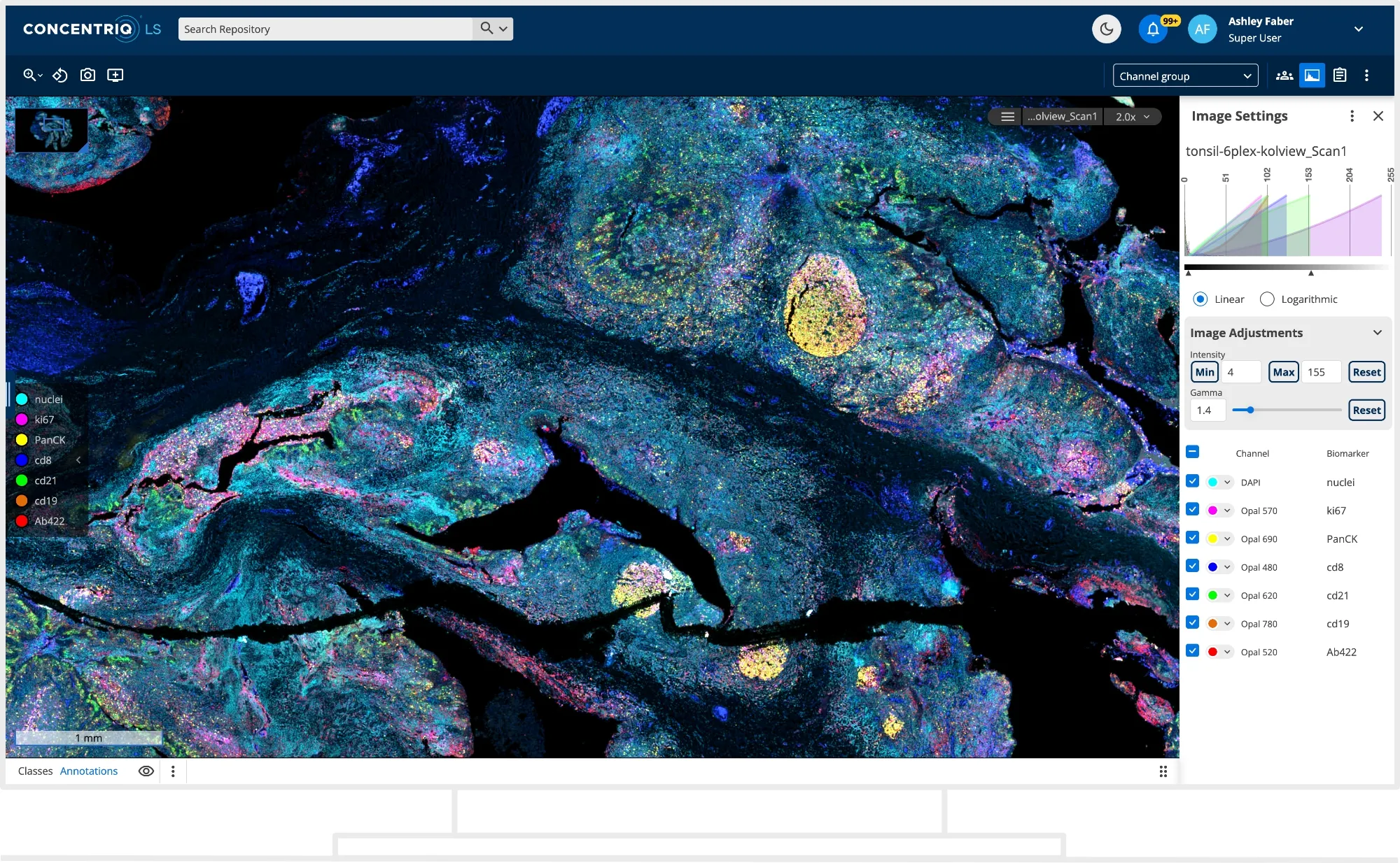 concentriq-ls-discovery_18_6-3.jpg