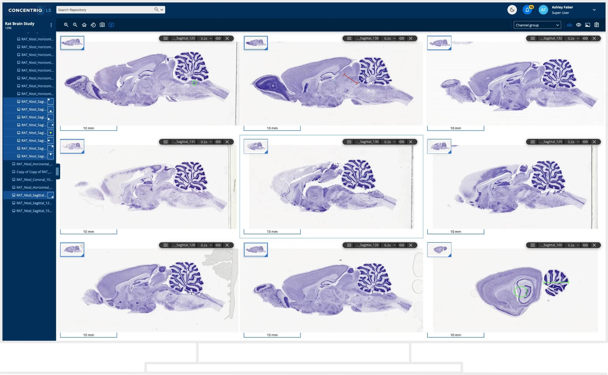concentriq-ls-preclinical-dev_16-3.jpg