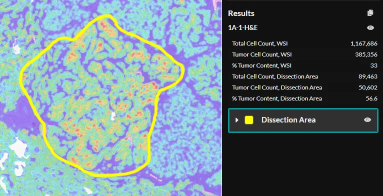 Macrodissection-UI-Close-Up.png