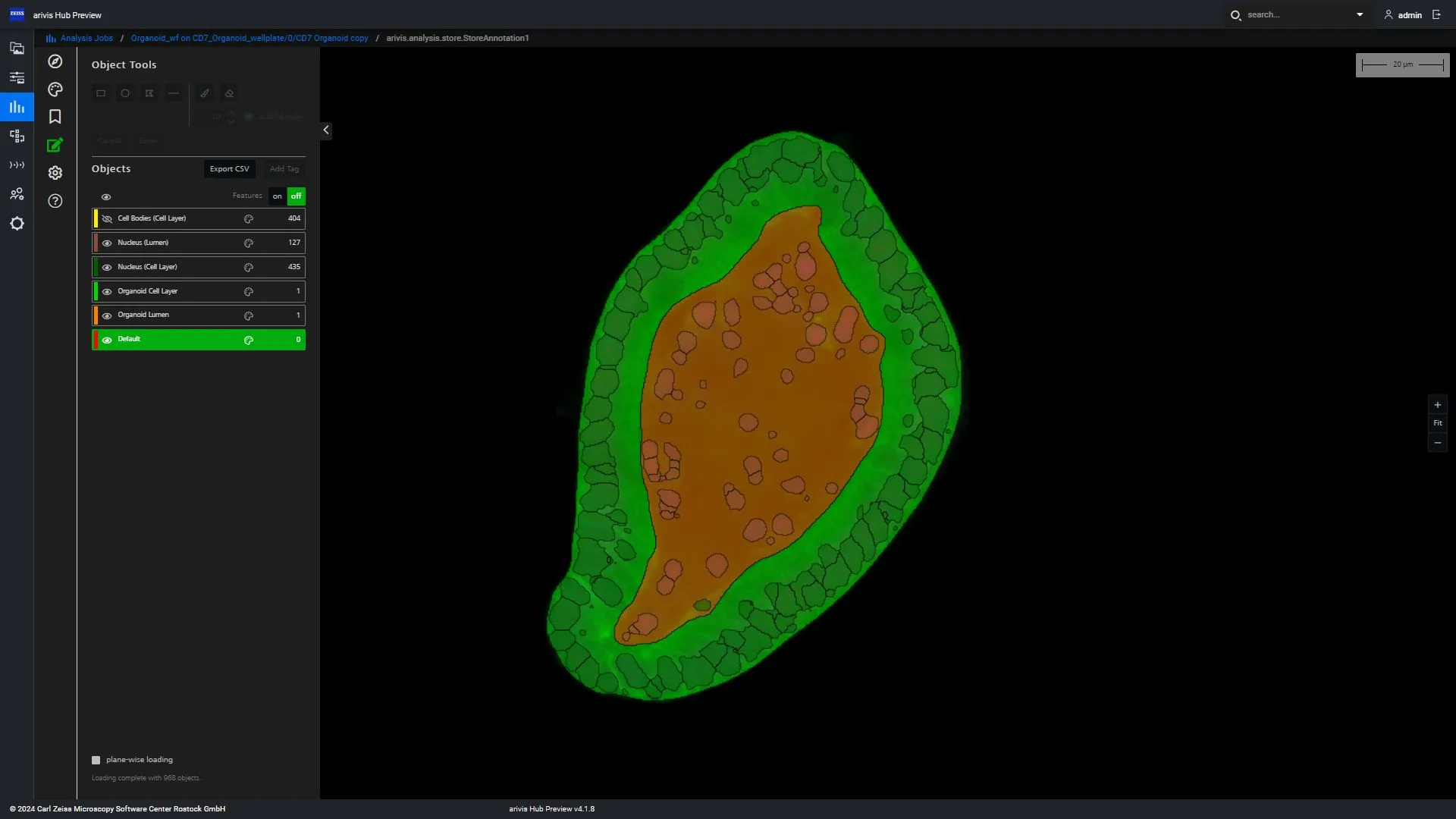 organoid_in_viewer.jpg
