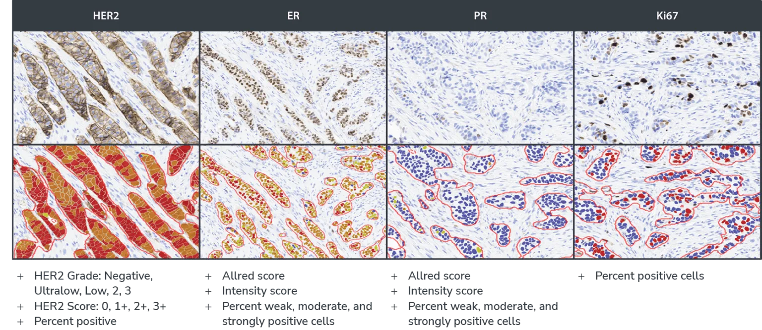 Breast-IHC-AI-Workflow-Graphic-Figure-3_Version-1.1-1536x666.png