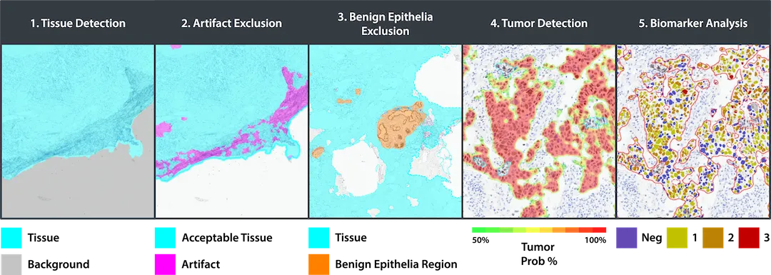 Breast-IHC-AI-Workflow-Graphic-Figure-2.png