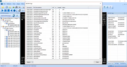 MicroDicomDicomTags_small.png