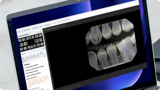 dentrix_ascend_block_2.png