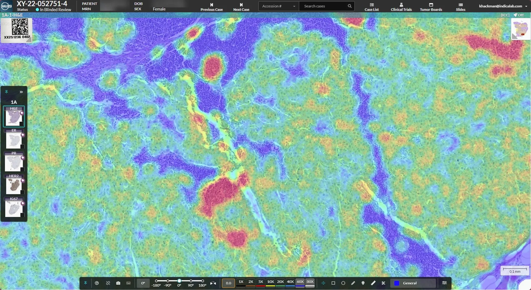 AI-Heatmap-2.jpg