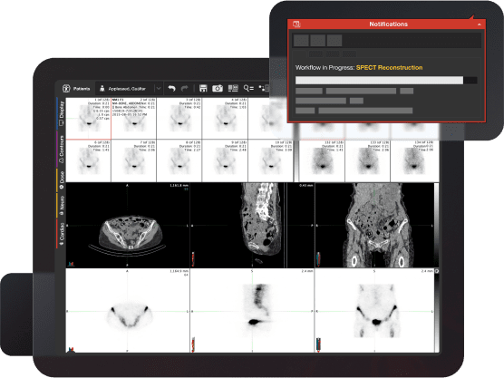 Spect-Image.webp