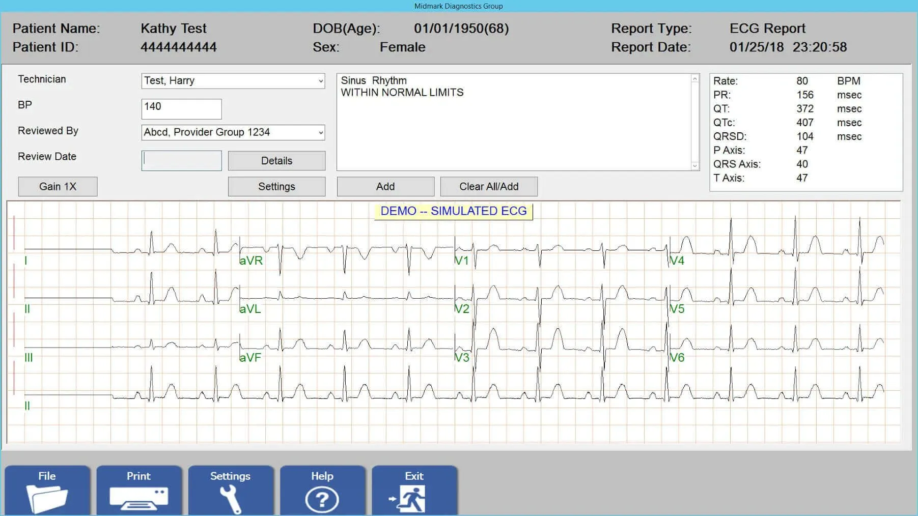 cardiology-patient-ECG-screenshot-1803x1014-1920w.jpg
