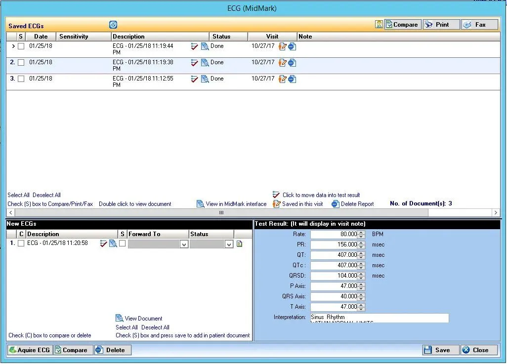 cardiology-access-patient-ECG-screenshot-1026x737-1920w.jpg