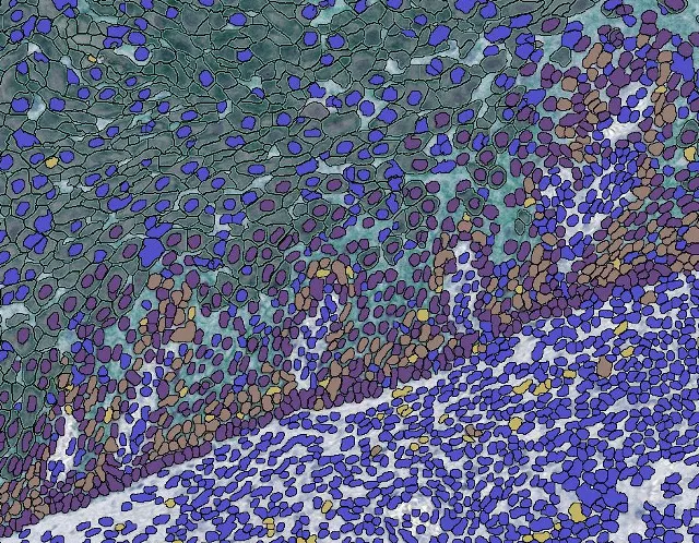 Multiplex-IHC-Markup_Cropped.jpg