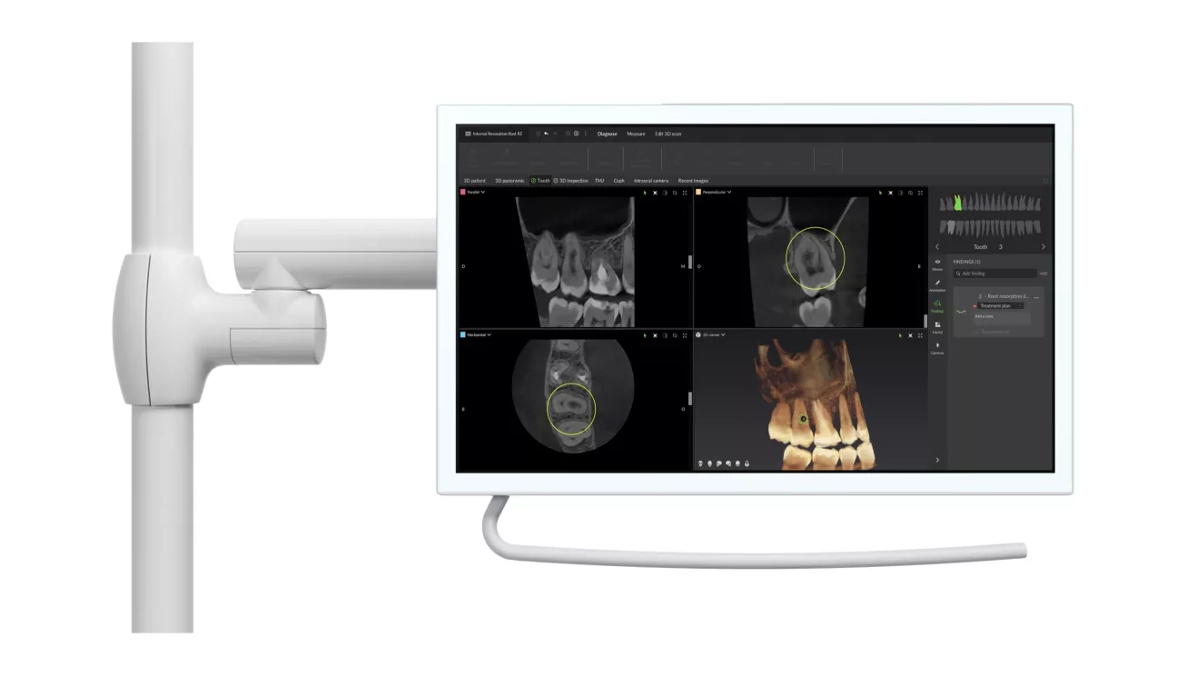 SmartFocus 2880x_0.jpg.webp