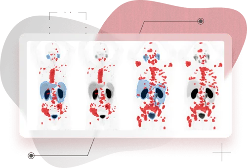 SPECT-LockUP.webp